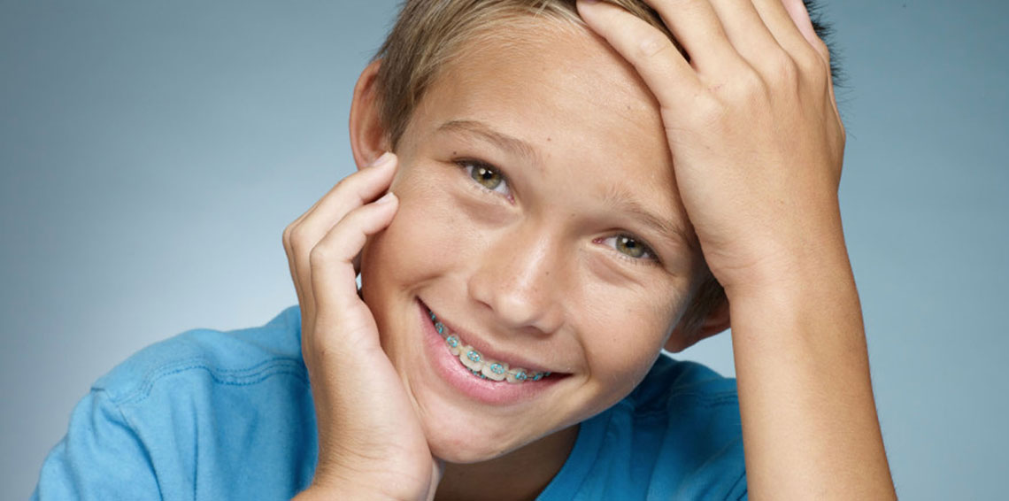 Apparecchio per allineare i denti