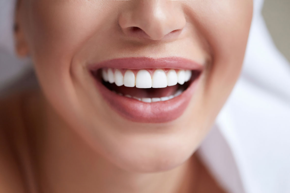 Faccette dentali Cesano Maderno